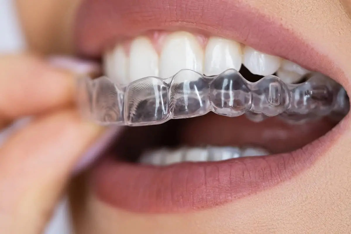 3D-printed dental aligner molds and trays used in Align Technology’s digital orthodontic workflow.